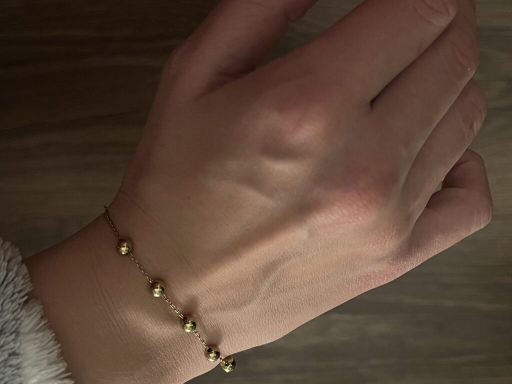 Prečo mi náhle výraznejšie vystúpili žily? Ide o bežný jav alebo signál, ktorý si vyžaduje návštevu lekára?